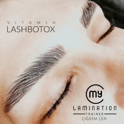 mylamintation2